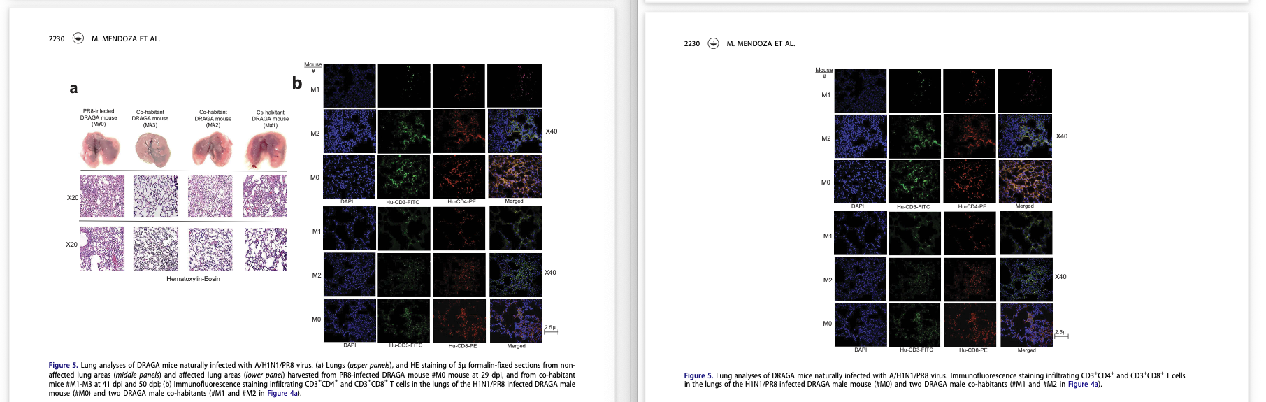 Example of stealth correction documented by Elisabeth Bik on PubPeer: Figure 5a and a portion of the caption for Figure 5 were removed post publication without notice.